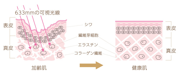 コラーゲンマシンの仕組み